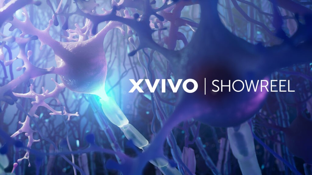 XVIVO Medical Animation Reel Thumbnail